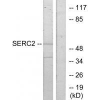 SERC2 Antibody[34036]