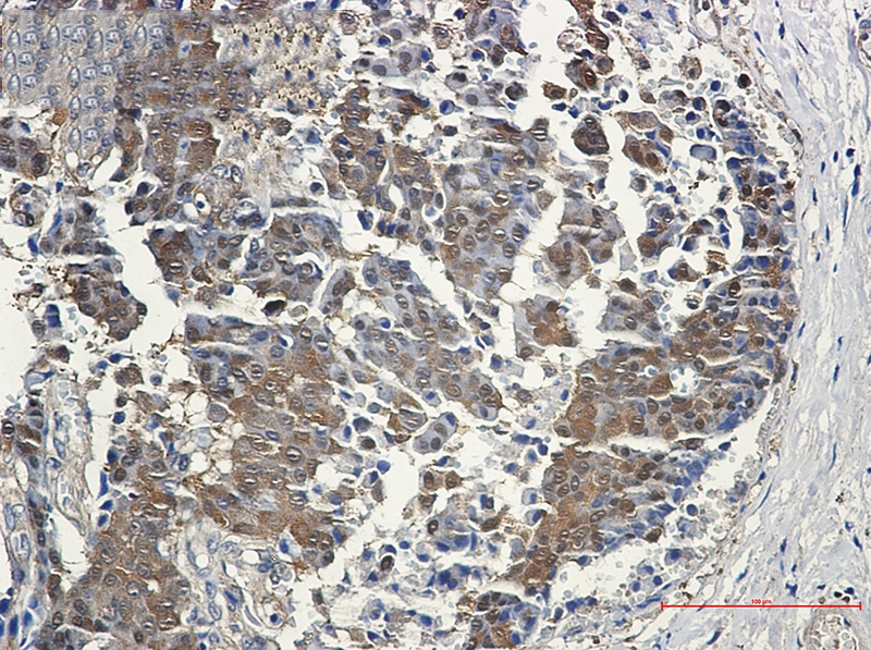 4E BP1 Rabbit mAb[52264]