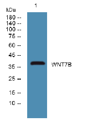 WNT7B Polyclonal Antibody[4920