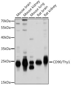 THY1 antibody[38373]