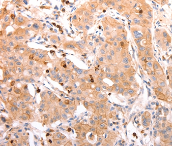 CELSR2 Antibody[37302]