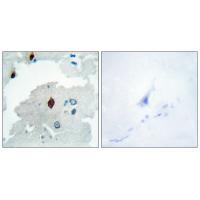 PTTG Antibody[33817]