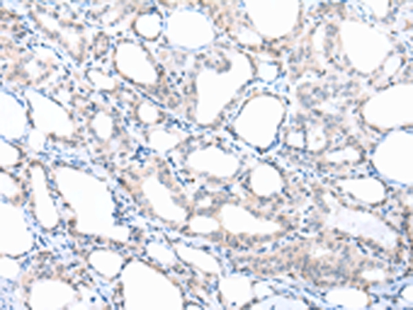 PPBP Antibody[43092]