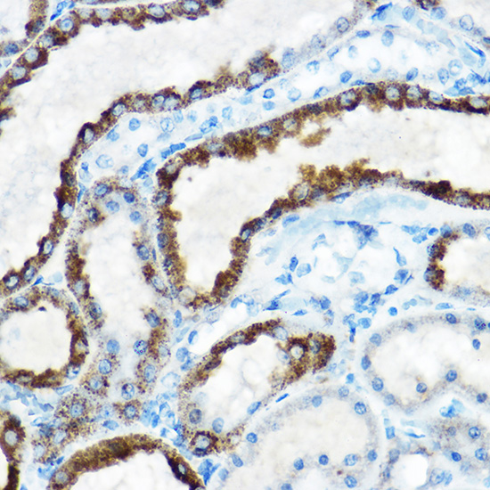 OAT antibody[38766]