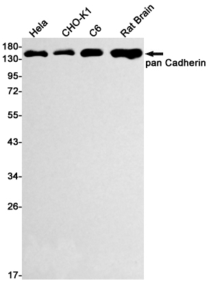 Cadherin Rabbit mAb[52486]