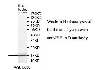 EIF1AD Antibody[39819]