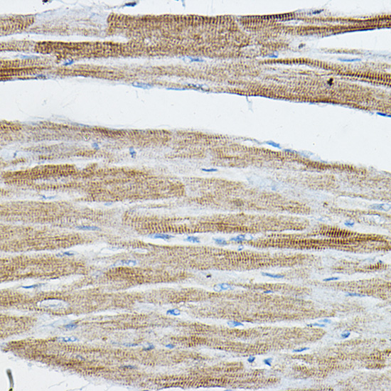 IRAK4 antibody[38750]