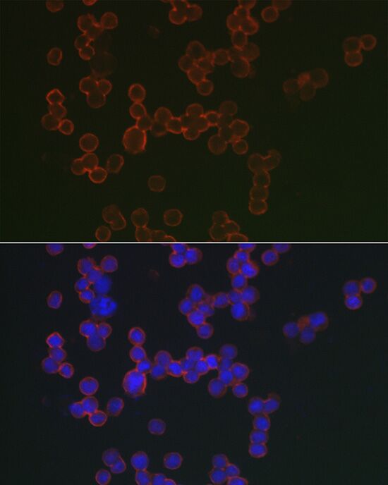 MS4A1 antibody[38300]