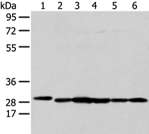 PRDX4 Antibody[43303]