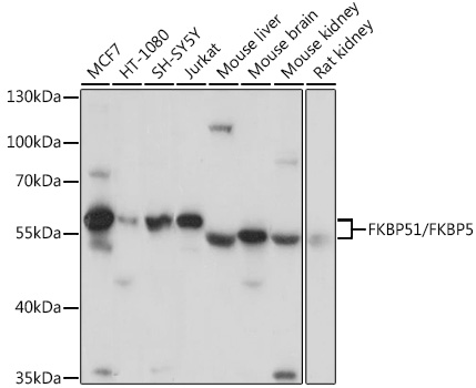 FKBP5 Rabbit Polyclonal Antibo