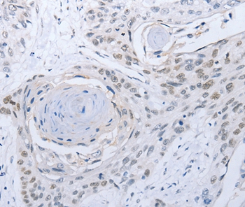 CAMK2B Antibody[35659]