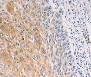 MUC5B Antibody[37171]