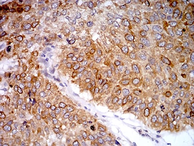 PGRMC1 Mouse mAb[64076]
