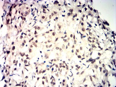 TDP43 Mouse mAb[64305]