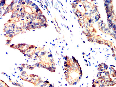 SH2B2 Mouse mAb[64229]