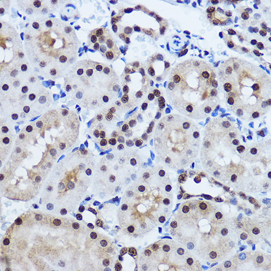 TARDBP Rabbit Polyclonal Antib