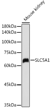 SLC5A1 antibody[38596]