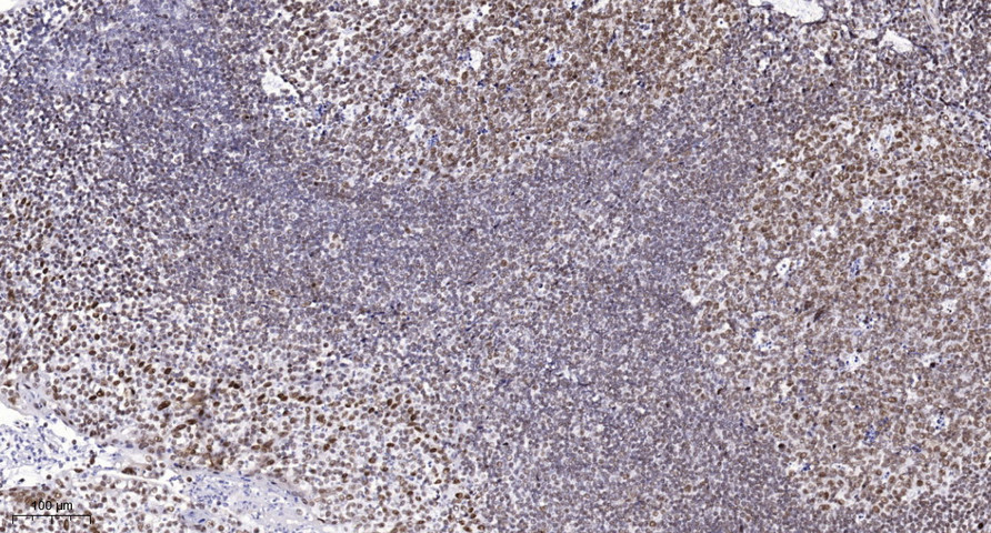 UBE3B antibody[62234]
