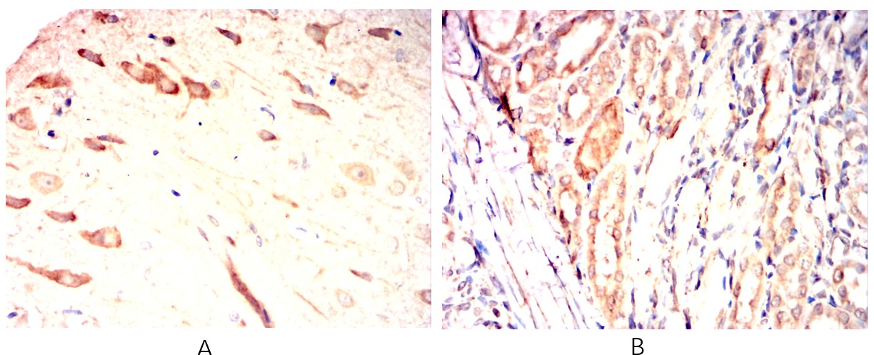 DCX Mouse mAb[63535]