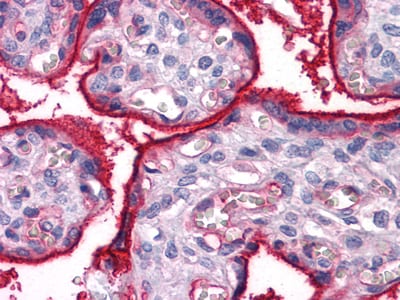 ITGA5 Mouse mAb[63796]