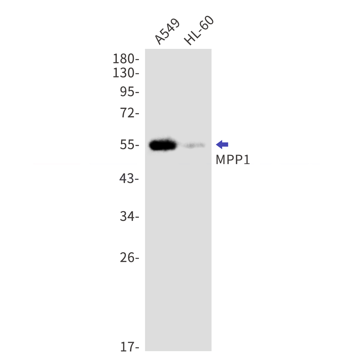 MPP1 Rabbit mAb[52809]