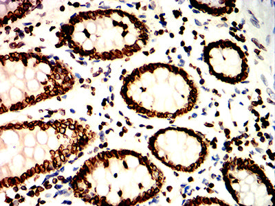 LMNB1 Mouse mAb[63874]