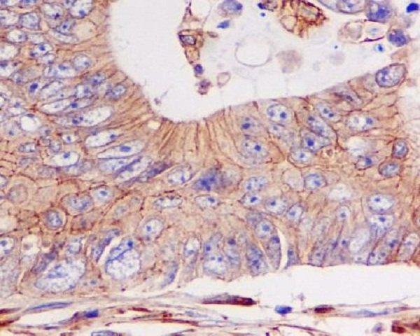 pan Cadherin Rabbit mAb[56046]