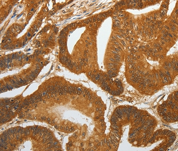 RETNLB Antibody[35905]