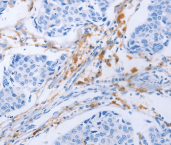LAIR1 Antibody[35800]