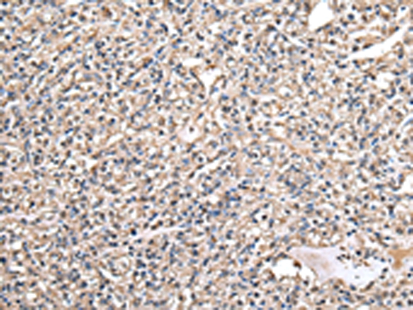 DARS Antibody[43072]