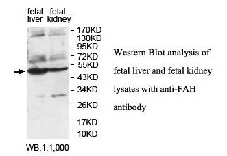 FAH Antibody[39846]