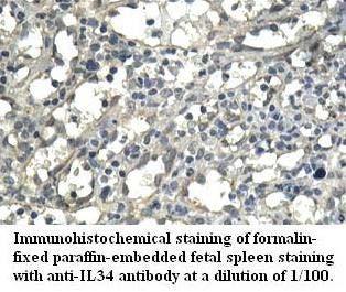IL34 Antibody[39576]