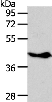 NFKBIE Antibody[35589]