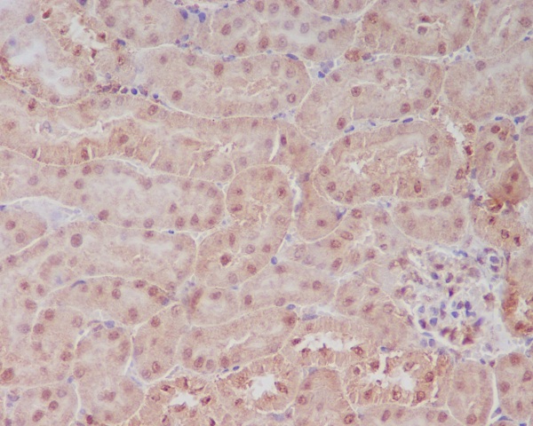 PELP1 Rabbit mAb[56045]