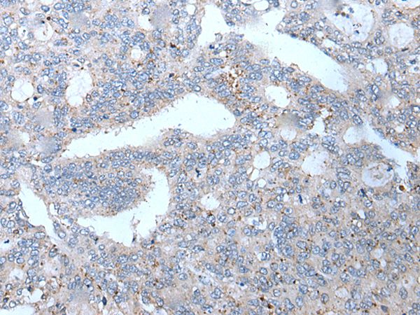 WFDC12 Antibody[43809]