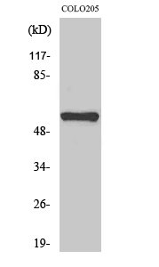 MITF Polyclonal Antibody[41145
