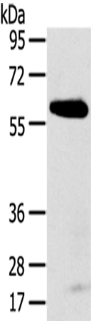 SPATA18 Antibody[43147]