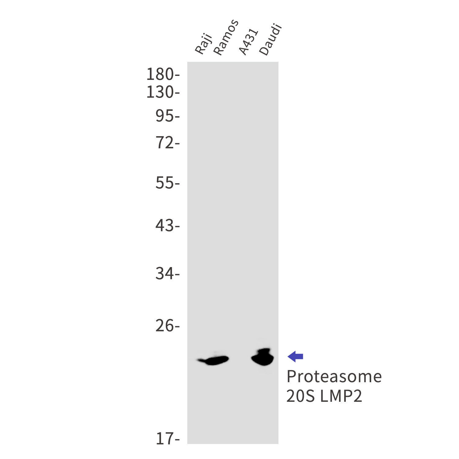 Proteasome beta 9 Rabbit mAb[5