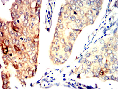 PPID Mouse mAb[64112]