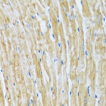 BAG3 Polyclonal Antibody[29195