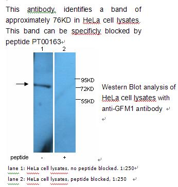 GFM1 Antibody[39229]