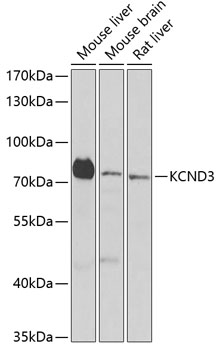 KCND3 Rabbit Polyclonal Antibo