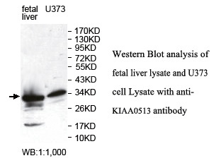 KIAA0513 Antibody[39784]