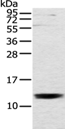 UQCRH Antibody[43353]