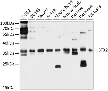 STX2 Rabbit Polyclonal Antibod