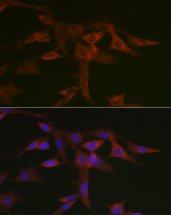 STAT5A Rabbit Polyclonal Antib