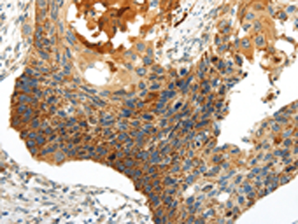 WNT8A Antibody[43193]