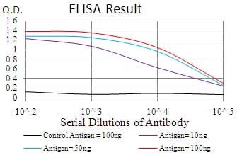 MGMT Mouse mAb[63931]