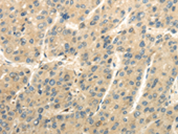 UBAP2L Antibody[42800]