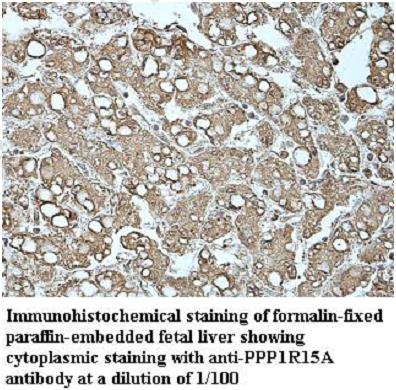 PPP1R15A Antibody[39948]